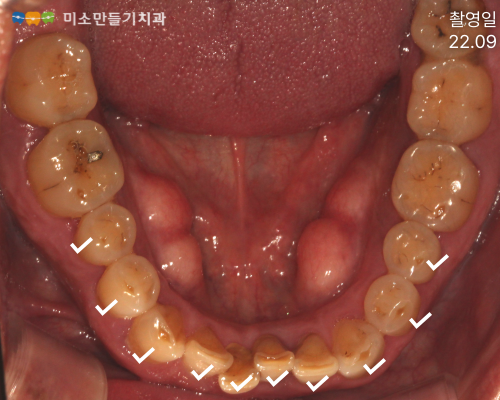 8dbb9c7678773e518044acaf7f402b62_003 (1).png